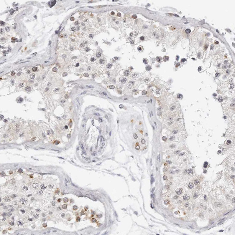 Atlas Antibodies Anti-CIART Antibody
