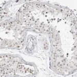 Atlas Antibodies Anti-CIART Antibody