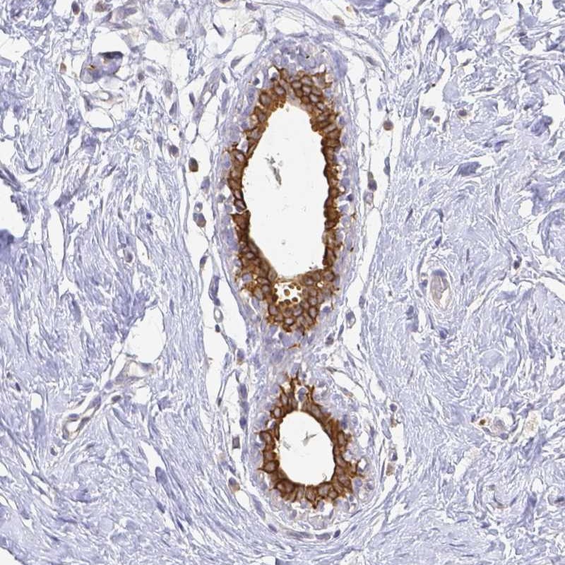 Atlas Antibodies Anti-CIB1 Antibody