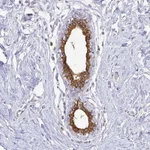 Atlas Antibodies Anti-CIB1 Antibody