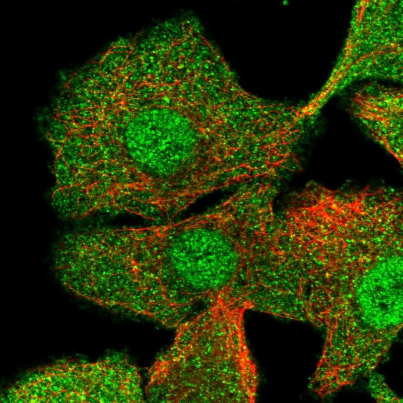 Atlas Antibodies Anti-CIB1 Antibody