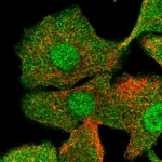 Atlas Antibodies Anti-CIB1 Antibody