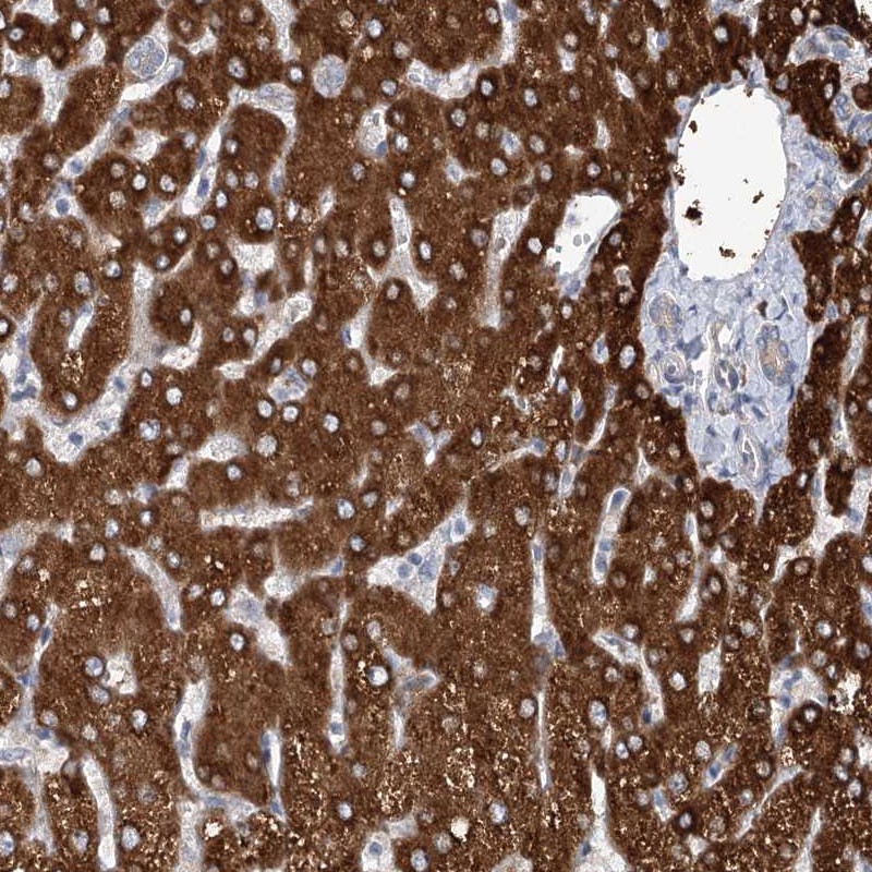 Atlas Antibodies Anti-CIB4 Antibody