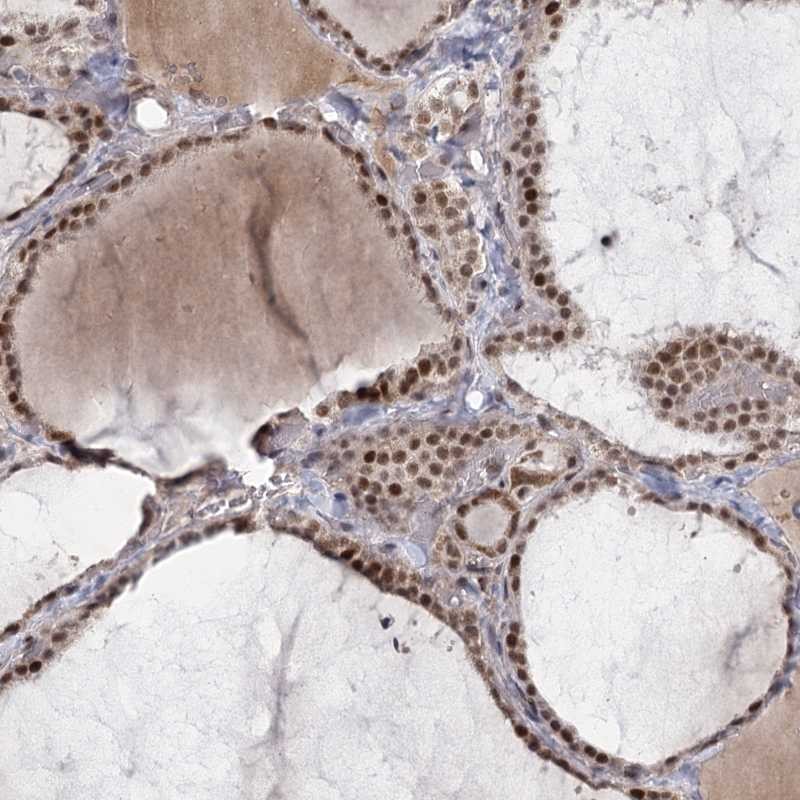 Atlas Antibodies Anti-CIB4 Antibody