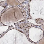 Atlas Antibodies Anti-CIB4 Antibody