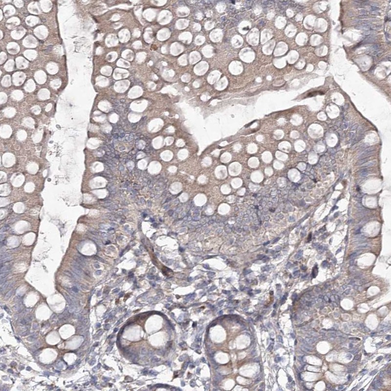 Atlas Antibodies Anti-CIB2 Antibody
