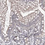 Atlas Antibodies Anti-CIB2 Antibody