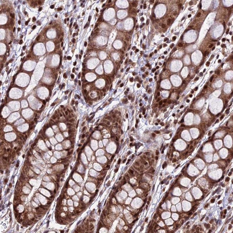 Atlas Antibodies Anti-CIB3 Antibody