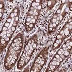 Atlas Antibodies Anti-CIB3 Antibody