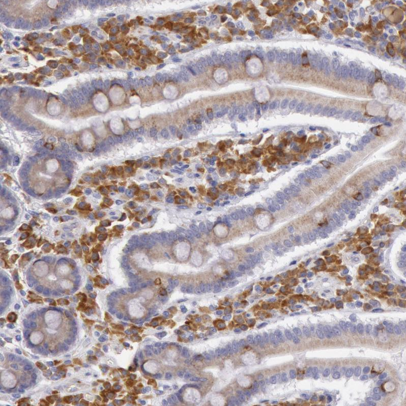 Atlas Antibodies Anti-CIDEB Antibody