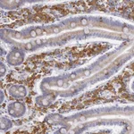 Atlas Antibodies Anti-CIDEB Antibody