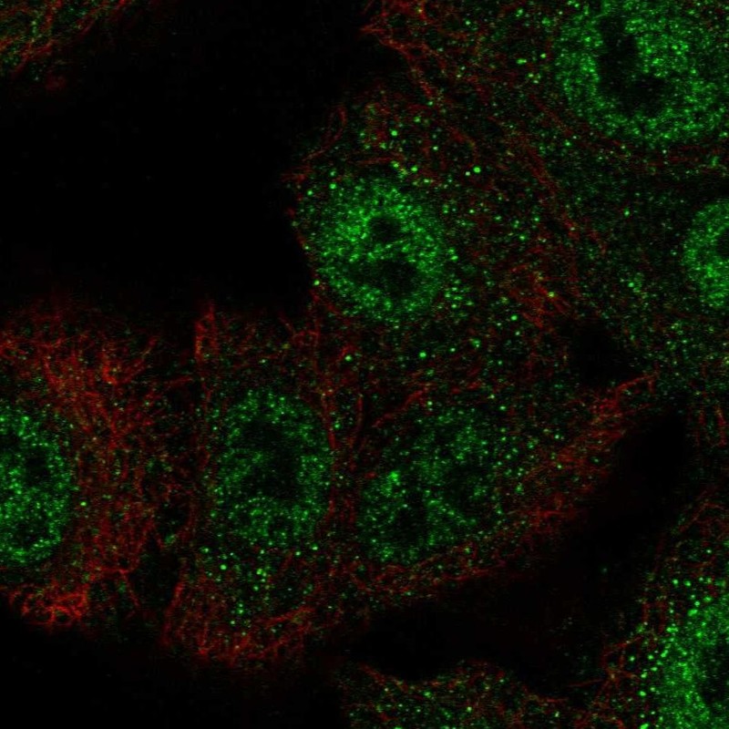 Atlas Antibodies Anti-CIC Antibody