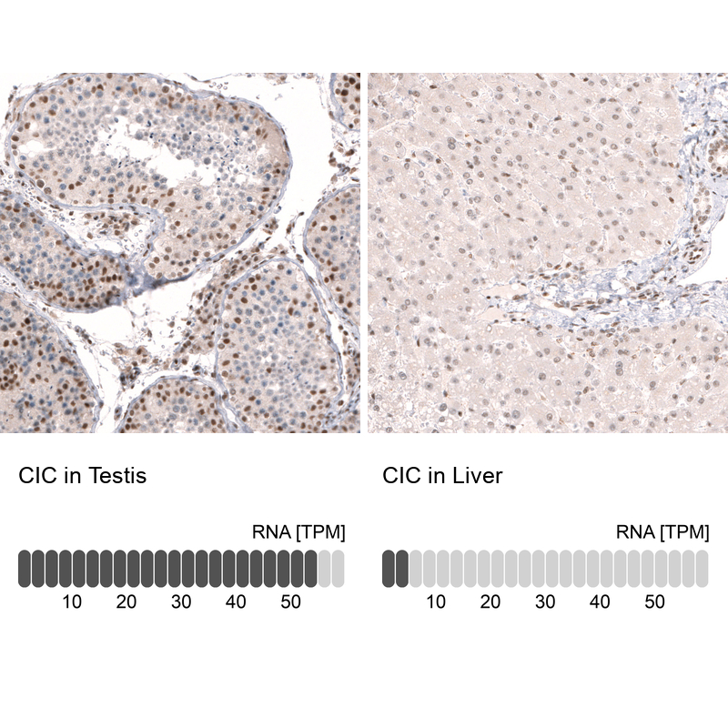 Atlas Antibodies Anti-CIC Antibody