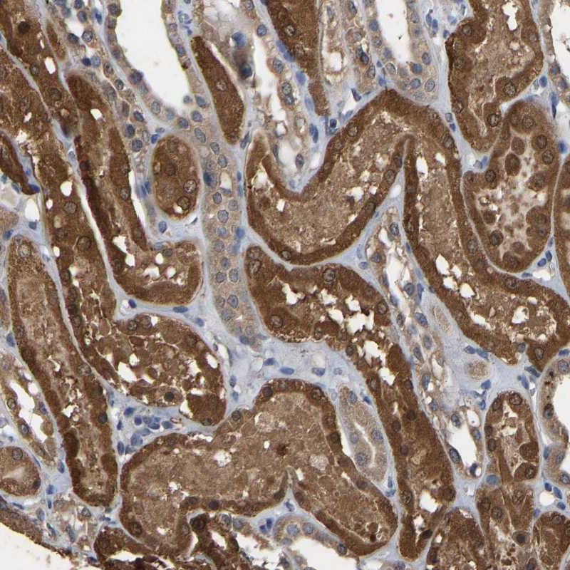 Atlas Antibodies Anti-CIDEC Antibody