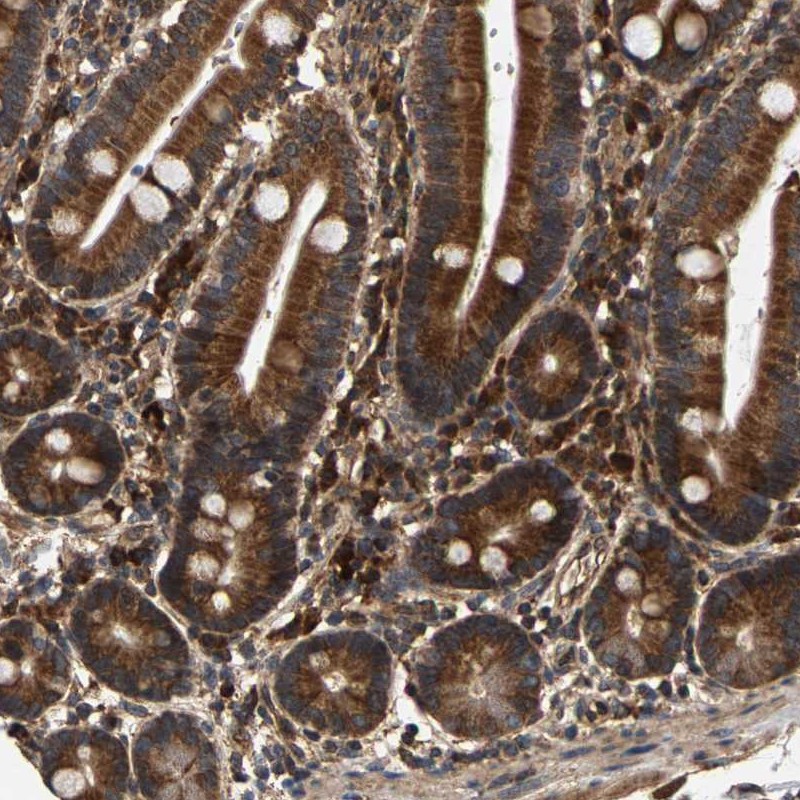 Atlas Antibodies Anti-CIDEC Antibody