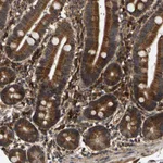 Atlas Antibodies Anti-CIDEC Antibody