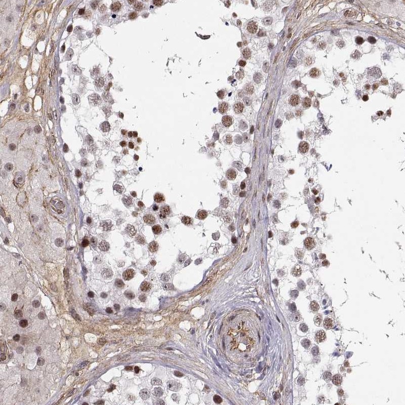Atlas Antibodies Anti-CIR1 Antibody