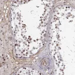 Atlas Antibodies Anti-CIR1 Antibody