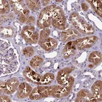 Atlas Antibodies Anti-CILP2 Antibody