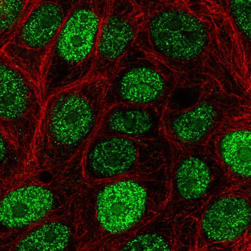 Atlas Antibodies Anti-CIRBP Antibody