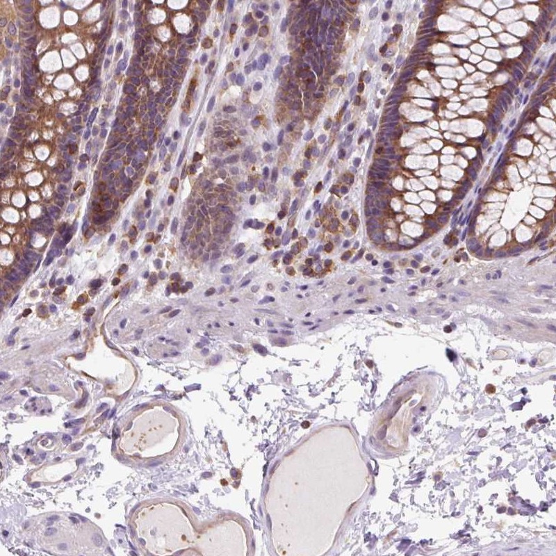 Atlas Antibodies Anti-CISD3 Antibody