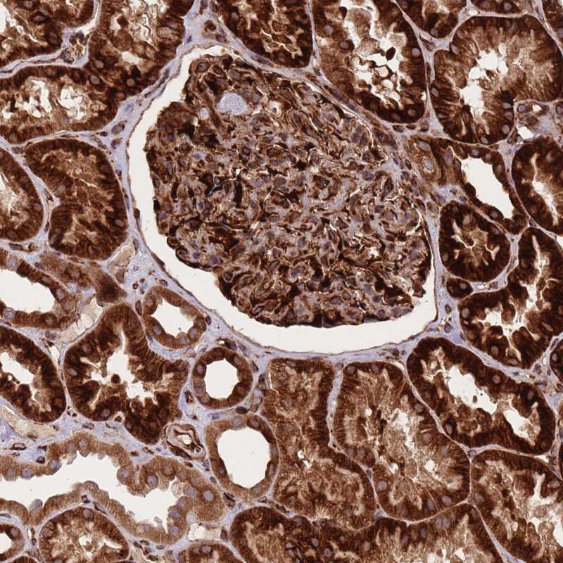 Atlas Antibodies Anti-CISH Antibody