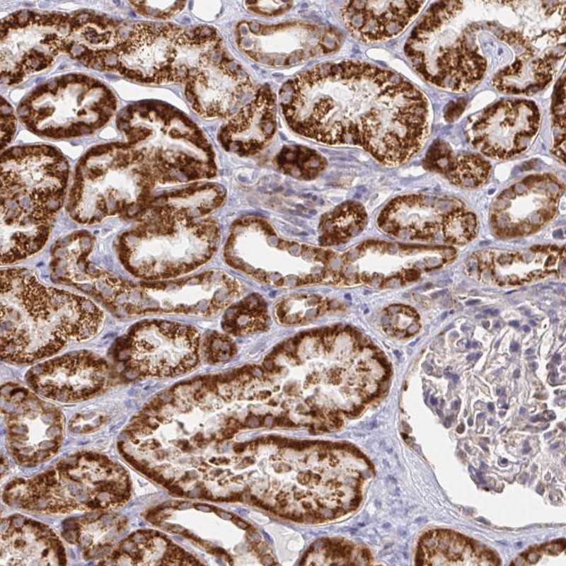 Atlas Antibodies Anti-CIT Antibody