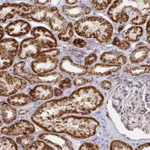 Atlas Antibodies Anti-CIT Antibody