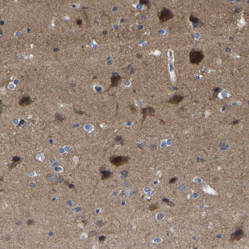 Atlas Antibodies Anti-CIT Antibody