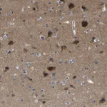 Atlas Antibodies Anti-CIT Antibody