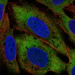 Atlas Antibodies Anti-CIT Antibody