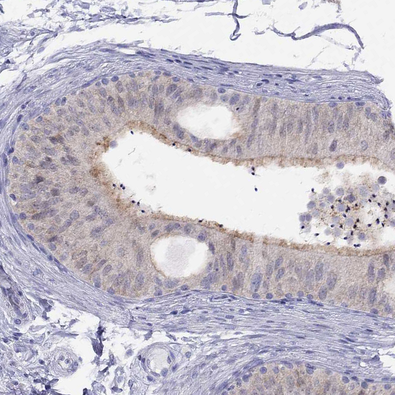 Atlas Antibodies Anti-CITED1 Antibody