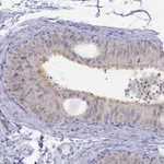 Atlas Antibodies Anti-CITED1 Antibody