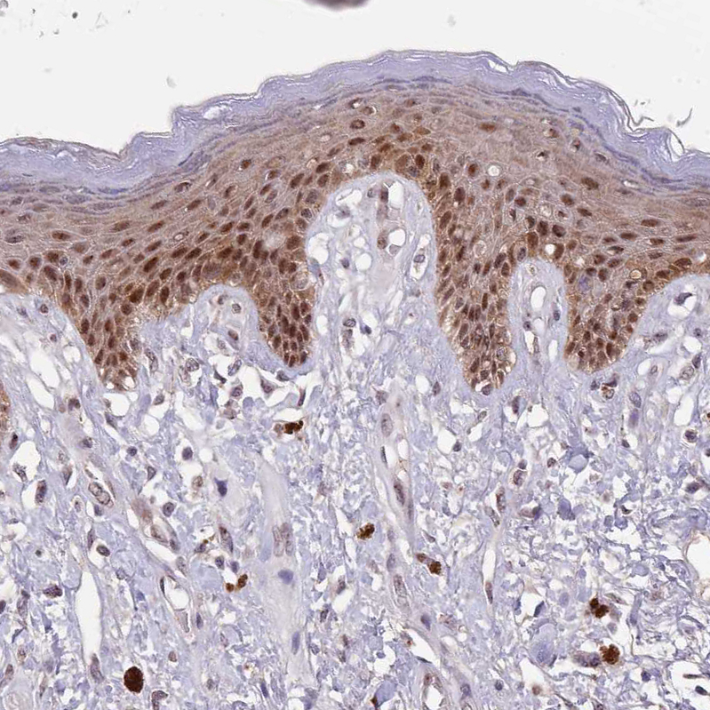 Atlas Antibodies Anti-CIZ1 Antibody