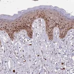 Atlas Antibodies Anti-CIZ1 Antibody