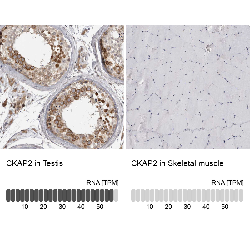 Atlas Antibodies Anti-CKAP2 Antibody