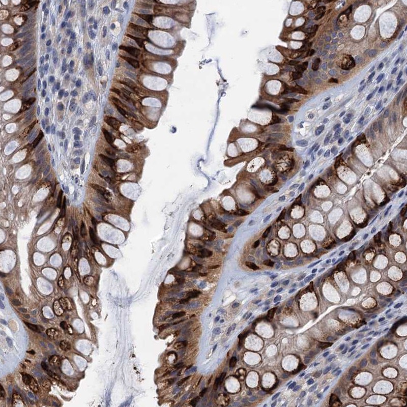 Atlas Antibodies Anti-CKAP2L Antibody