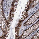 Atlas Antibodies Anti-CKAP2L Antibody