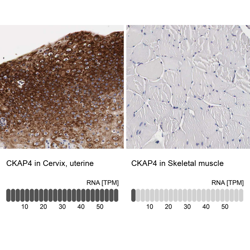 Atlas Antibodies Anti-CKAP4 Antibody
