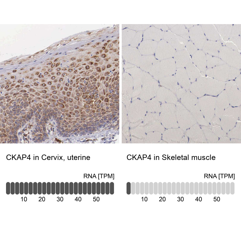 Atlas Antibodies Anti-CKAP4 Antibody