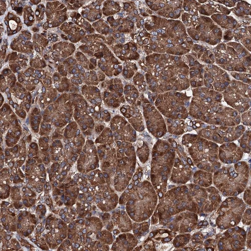 Atlas Antibodies Anti-CKAP5 Antibody