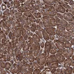 Atlas Antibodies Anti-CKAP5 Antibody