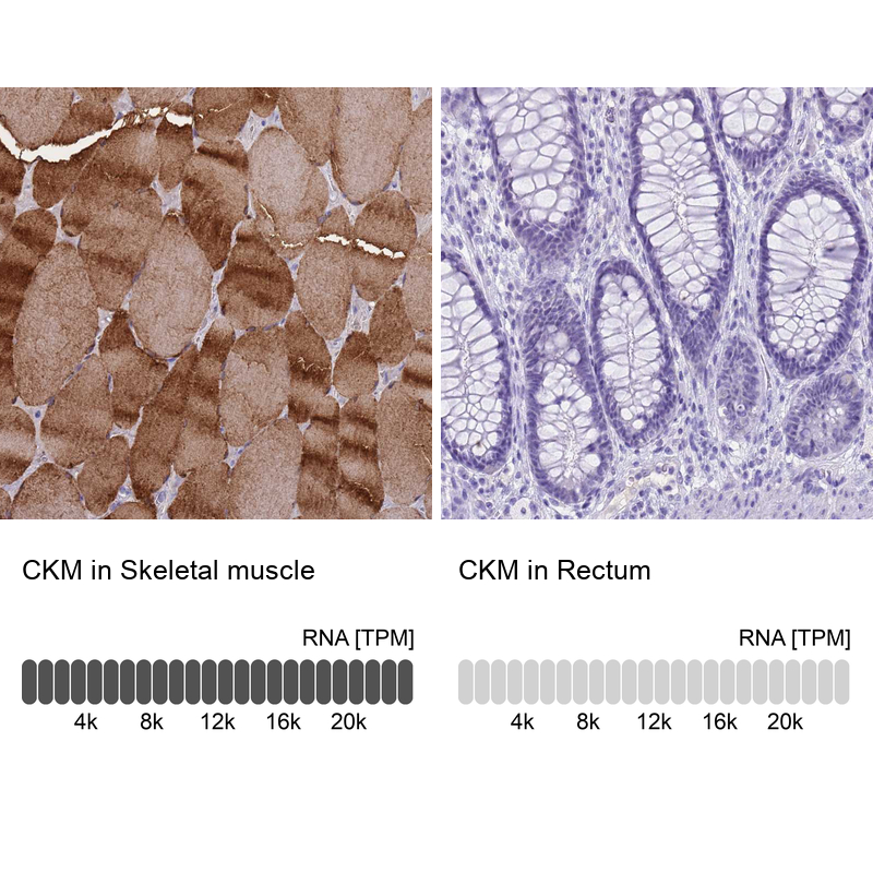 Atlas Antibodies Anti-CKM Antibody