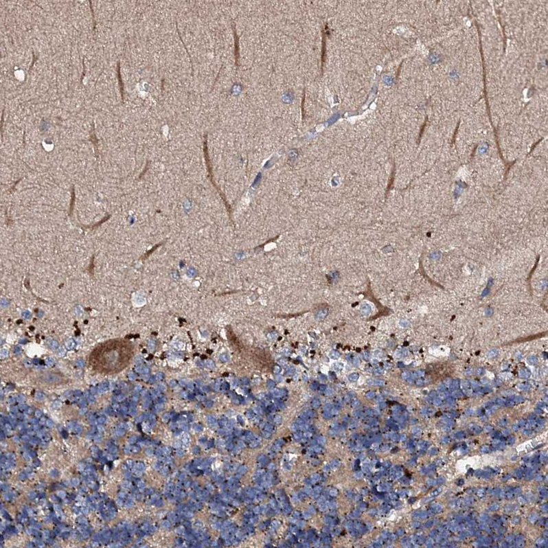 Atlas Antibodies Anti-CKAP5 Antibody
