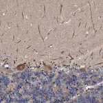 Atlas Antibodies Anti-CKAP5 Antibody