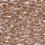 Atlas Antibodies Anti-CLASP1 Antibody