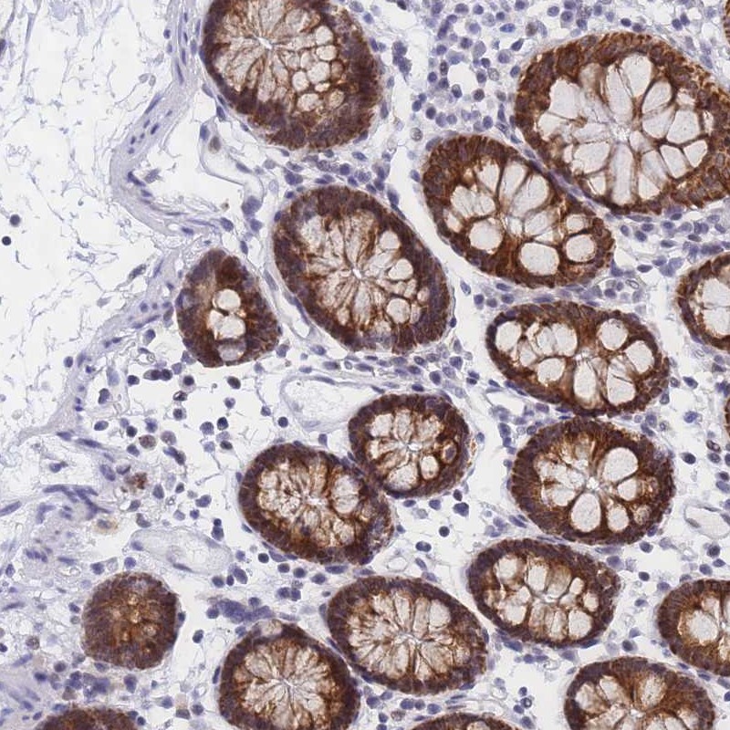 Atlas Antibodies Anti-CKMT1A Antibody