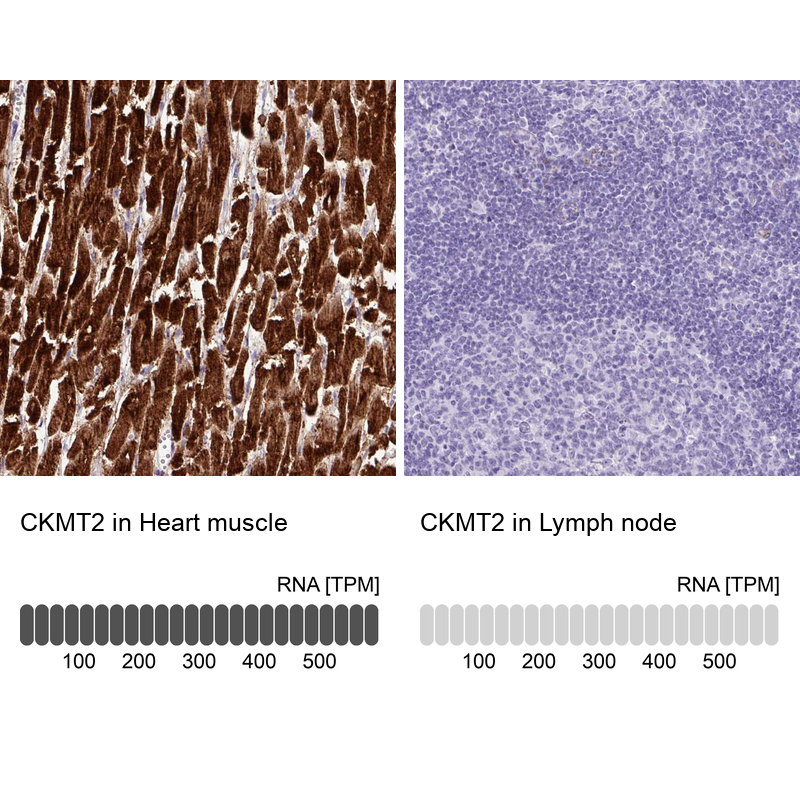 Atlas Antibodies Anti-CKMT2 Antibody