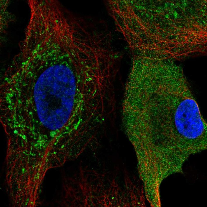 Atlas Antibodies Anti-CKS2 Antibody
