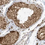 Atlas Antibodies Anti-CKS2 Antibody